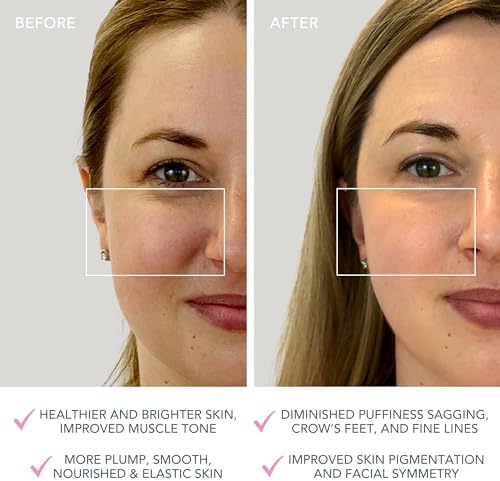 Lumi lift pro